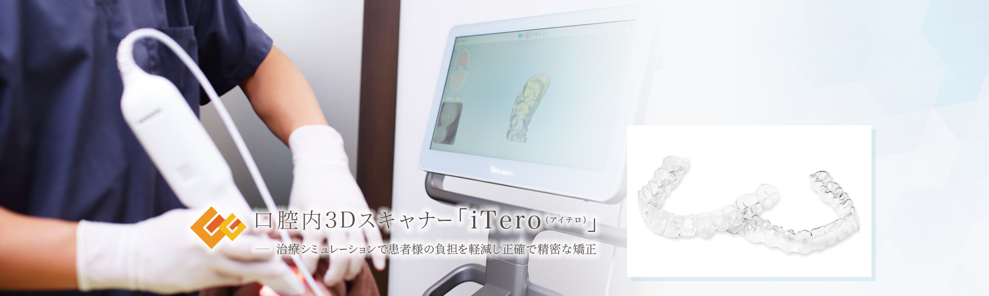 口腔内3Dスキャナー「iTero（アイテロ）」