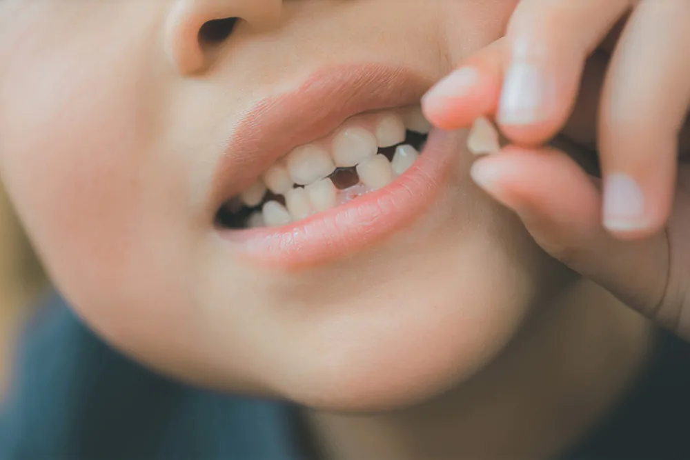 乳歯の抜き方や注意点