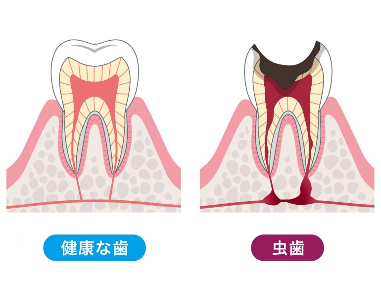 進行状態＆治療方法